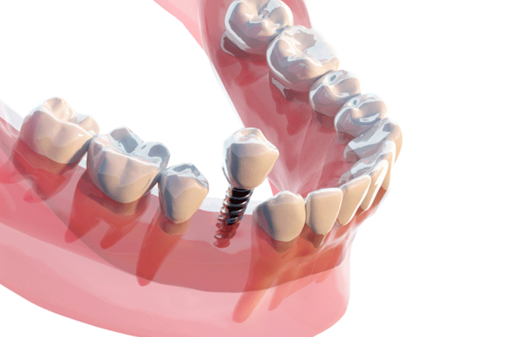 小児歯科・小児矯正・妊婦さんの治療