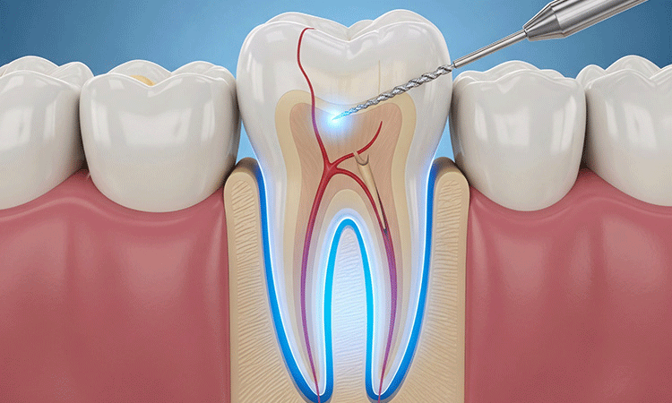 審美歯科・ホワイトニング