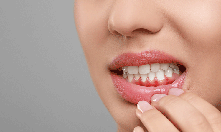 審美歯科・ホワイトニング